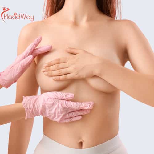 Breast Augmentation in Mexico for Toronto Patients Looking for Affordable Implants